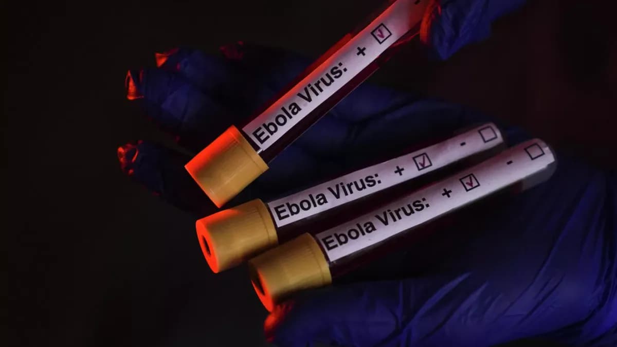 Rusya’nın yeni Ebola aşısında ön testler tamamlandı
