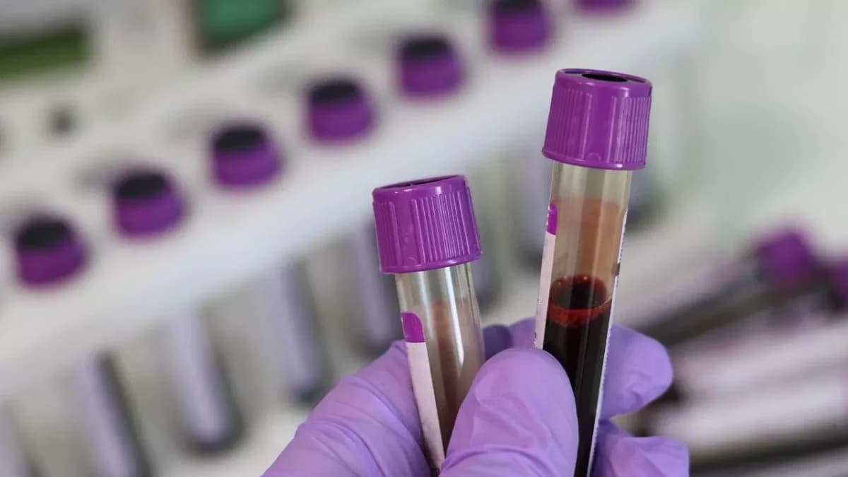 Prostat kanserinde yeni keşif: Hastalık 15 yıl önceden anlaşılabilir mi?