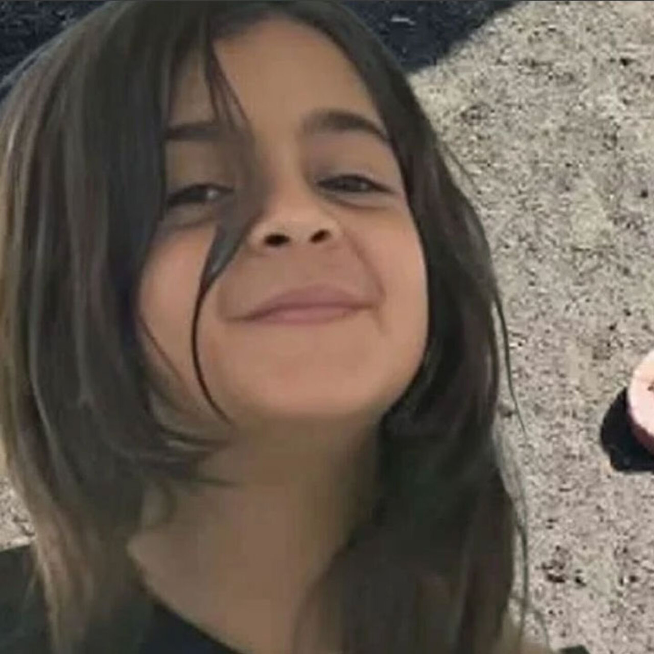 Narin’in boynundaki kanama dikkat çekti! İşte ‘Histopatoloji’ raporu!