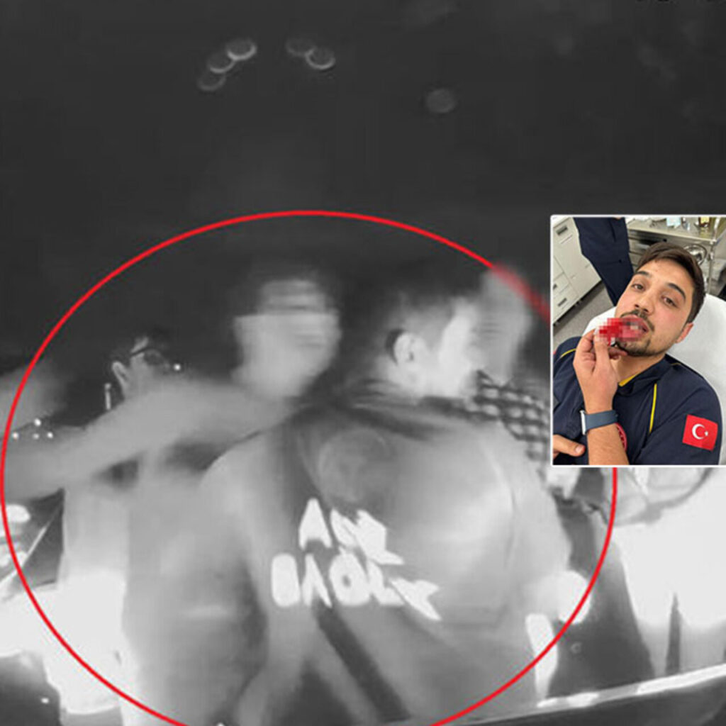 Baba oğul, ambulansın önünü kesip darp etmişti! Yerlikaya’dan açıklama!