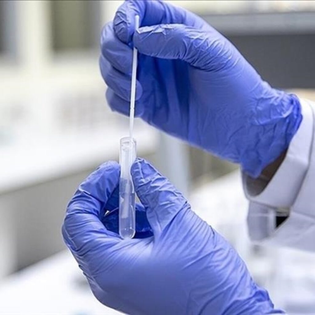 Covid-19 testi verenlerin yarısı pozitif çıkıyor