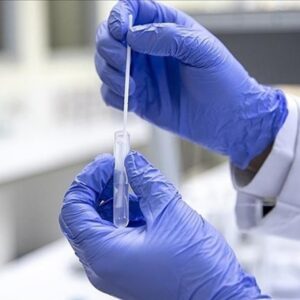 Covid-19 testi verenlerin yarısı pozitif çıkıyor