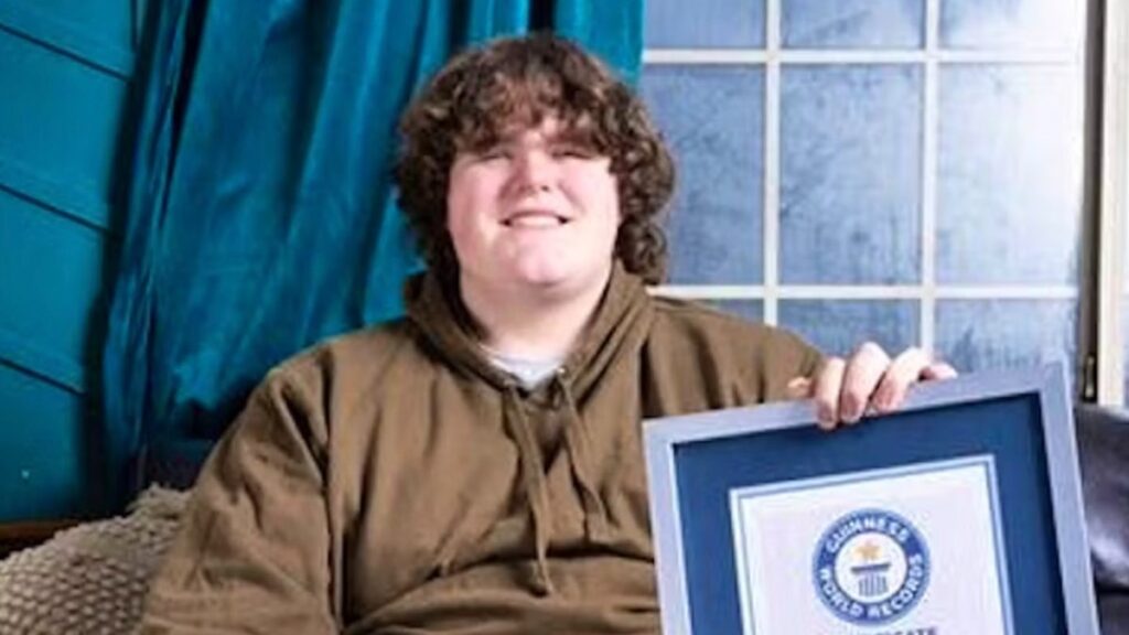 Dünyanın en büyük el ve ayaklarına sahip genç, Guinness Rekorlar Kitabı’na girdi