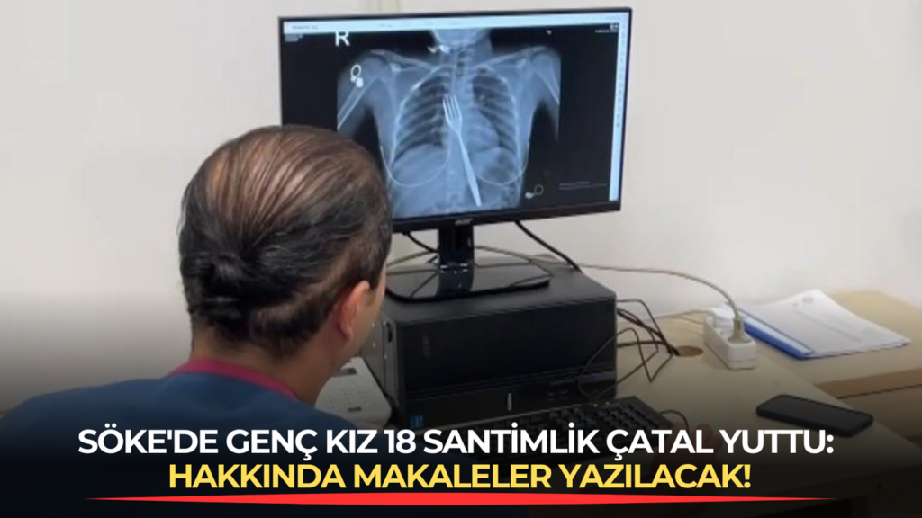 Söke’de genç kız 18 santimlik çatal yuttu: Hakkında makaleler yazılacak!