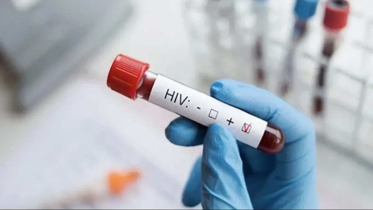 Kızılay’dan ‘AIDS’li kan’ iddiasıyla ilgili açıklama