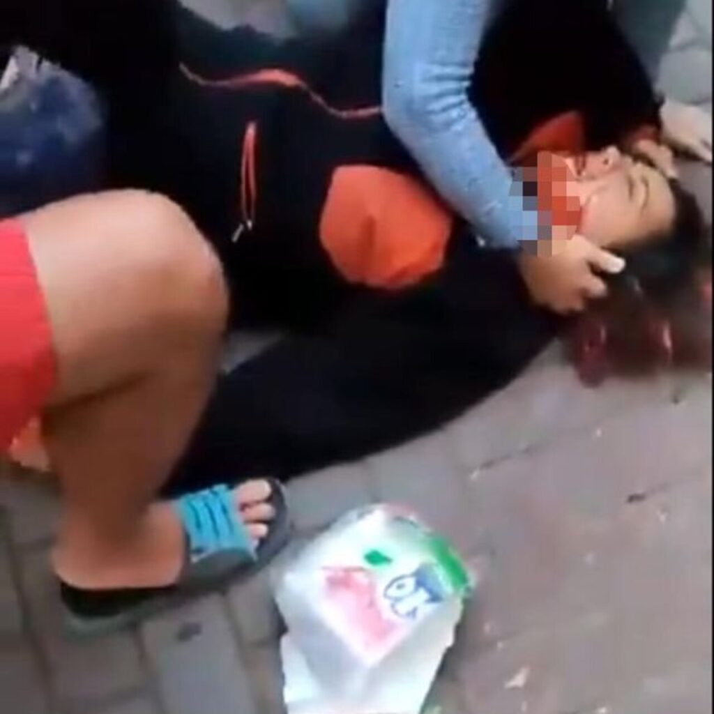 Profesör köpeklerin saldırısında yaralandı