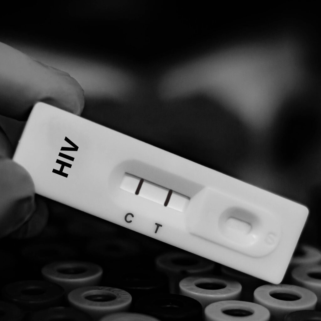 Türkiye’de çocuklarda HIV vakaları artıyor