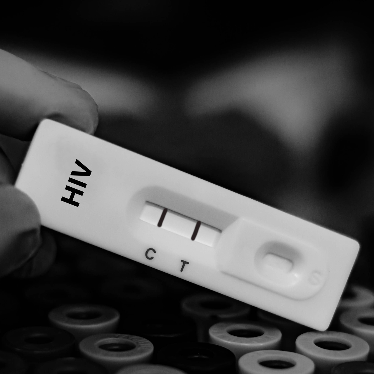 Türkiye’de çocuklarda HIV vakaları artıyor