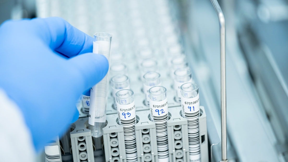 323 şişe ölümcül virüs kayıp: Peş peşe açıklamalar geliyor