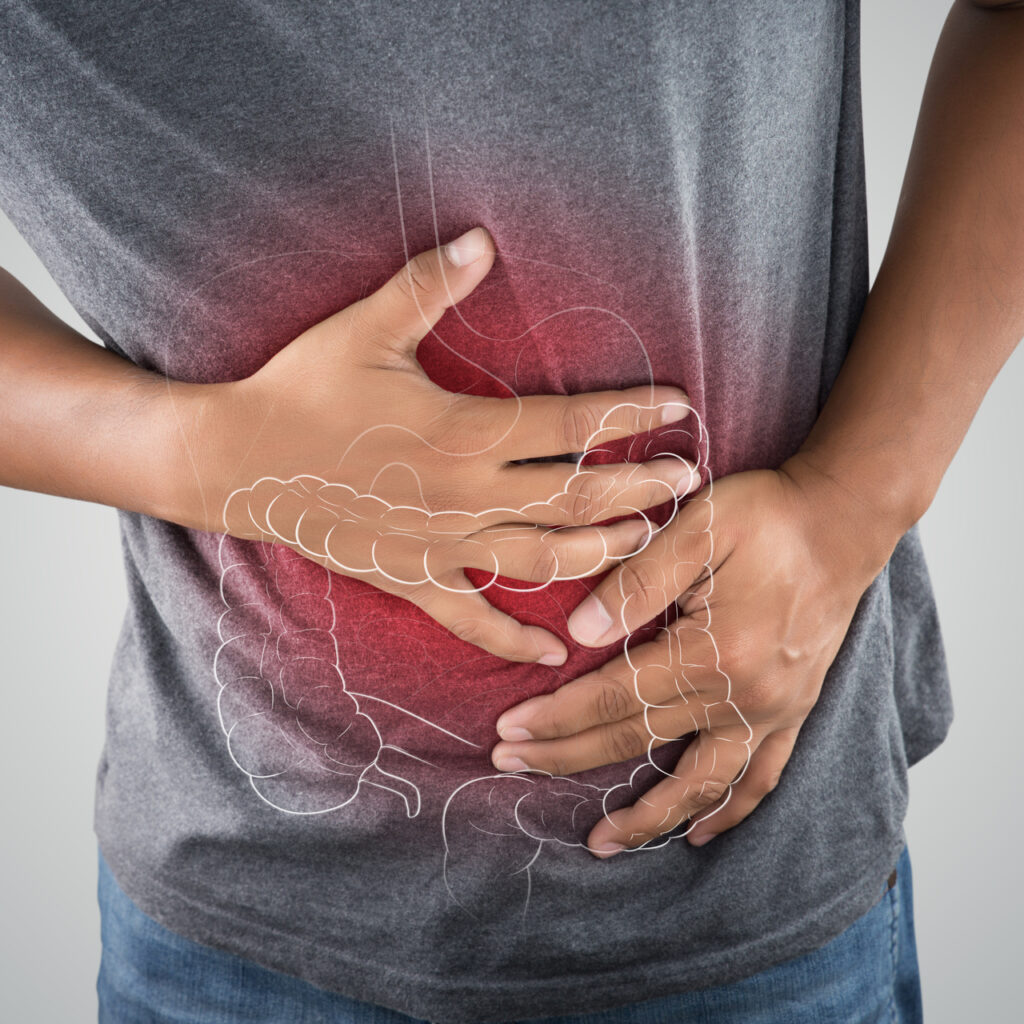 Bağırsak iltihabı kansere dönüşür mü?