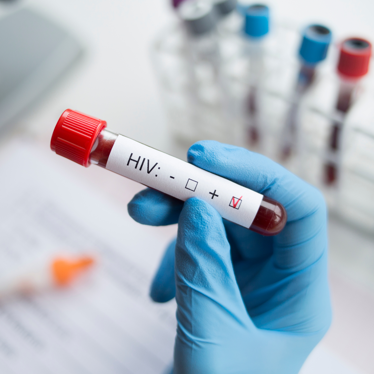 Önyargılar HIV ile mücadeleyi baltalıyor