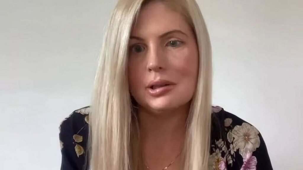 1 dakikalık baş ağrısı hayatını değiştirdi