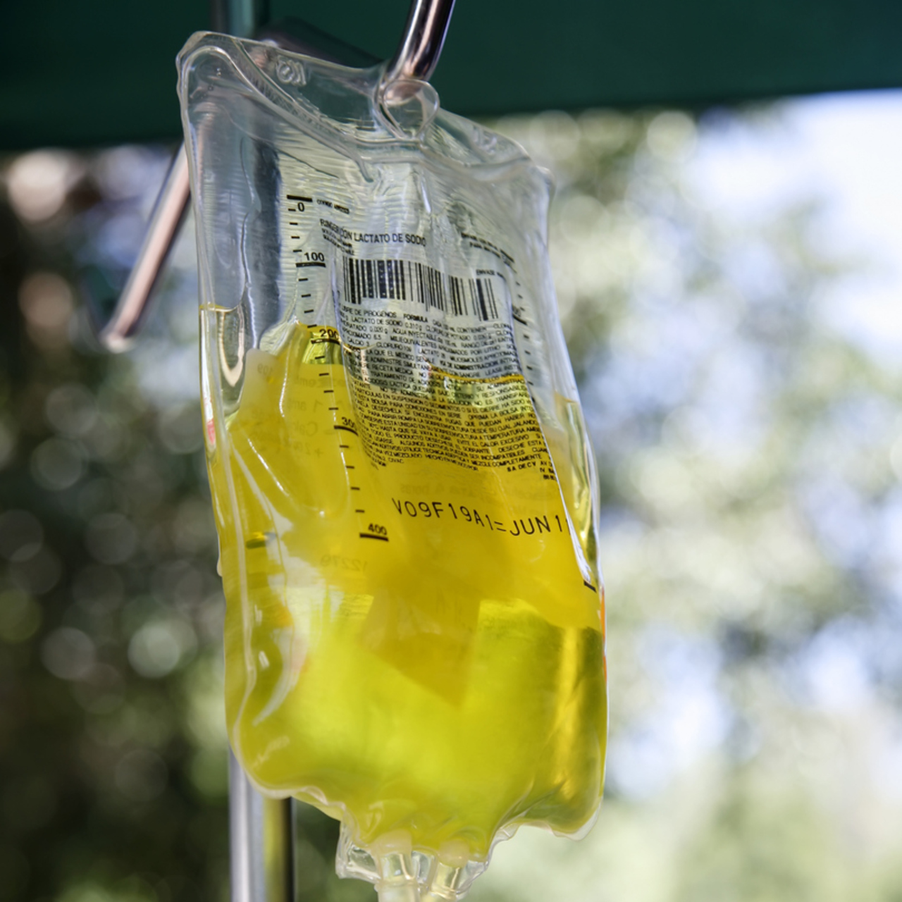 1500 liraya sarı ölüm