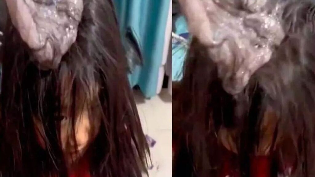 Annesi kızının kafasındakini görünce soluğu hastanede aldı