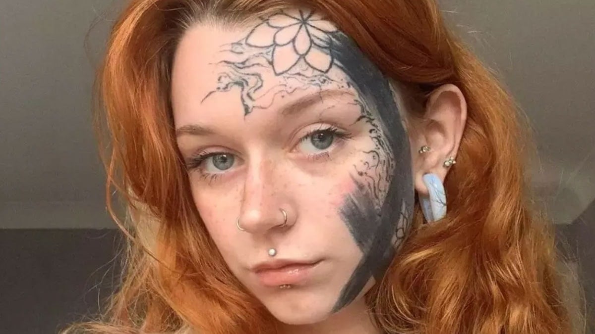 Nişanlısına izin verip bu hale geldi… Köprücük kemiğinden vücuduna yayılıyor