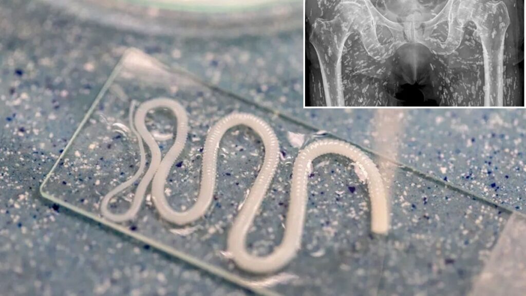 Tek bir pişirme hatasıyla vücudunu binlercesi sardı!