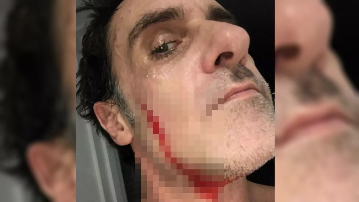 Tıraş olurken kendini kesince 211 bin lira kazandı