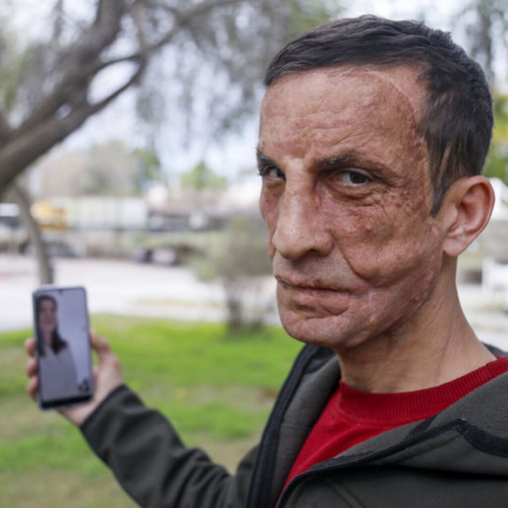 "Babamın yüzü Uğur’da yaşıyor"