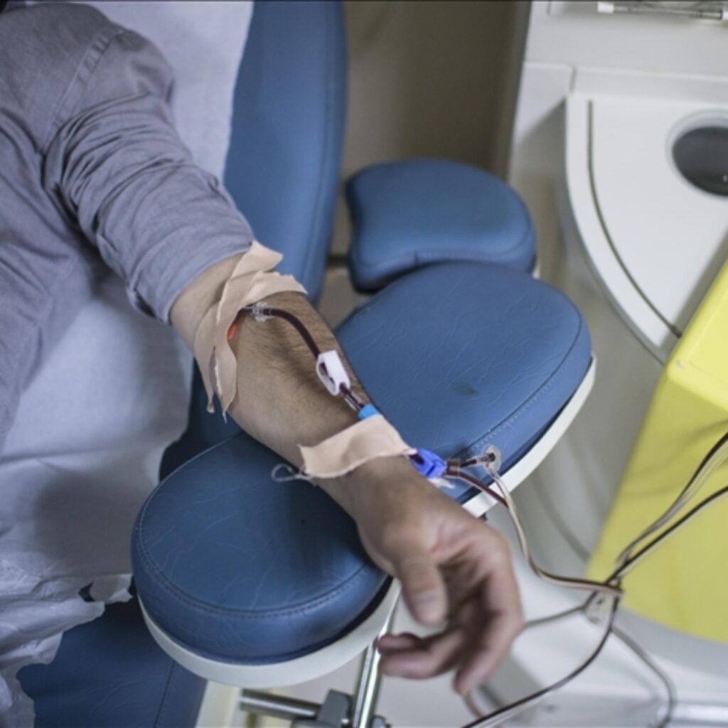 "Kuru cilt" böbrek hastalıklarında belirti olabilir