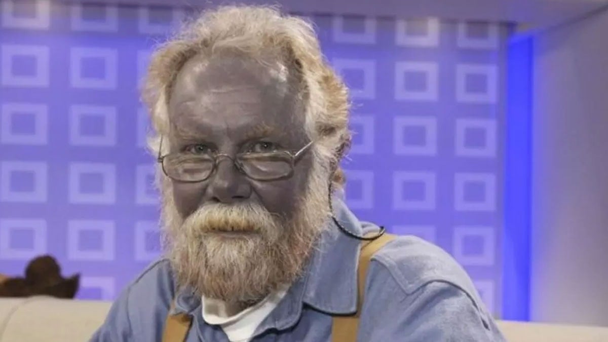 İçtiği karışımla ‘Şirin Baba’ya döndü: Herkesin başına gelebilir