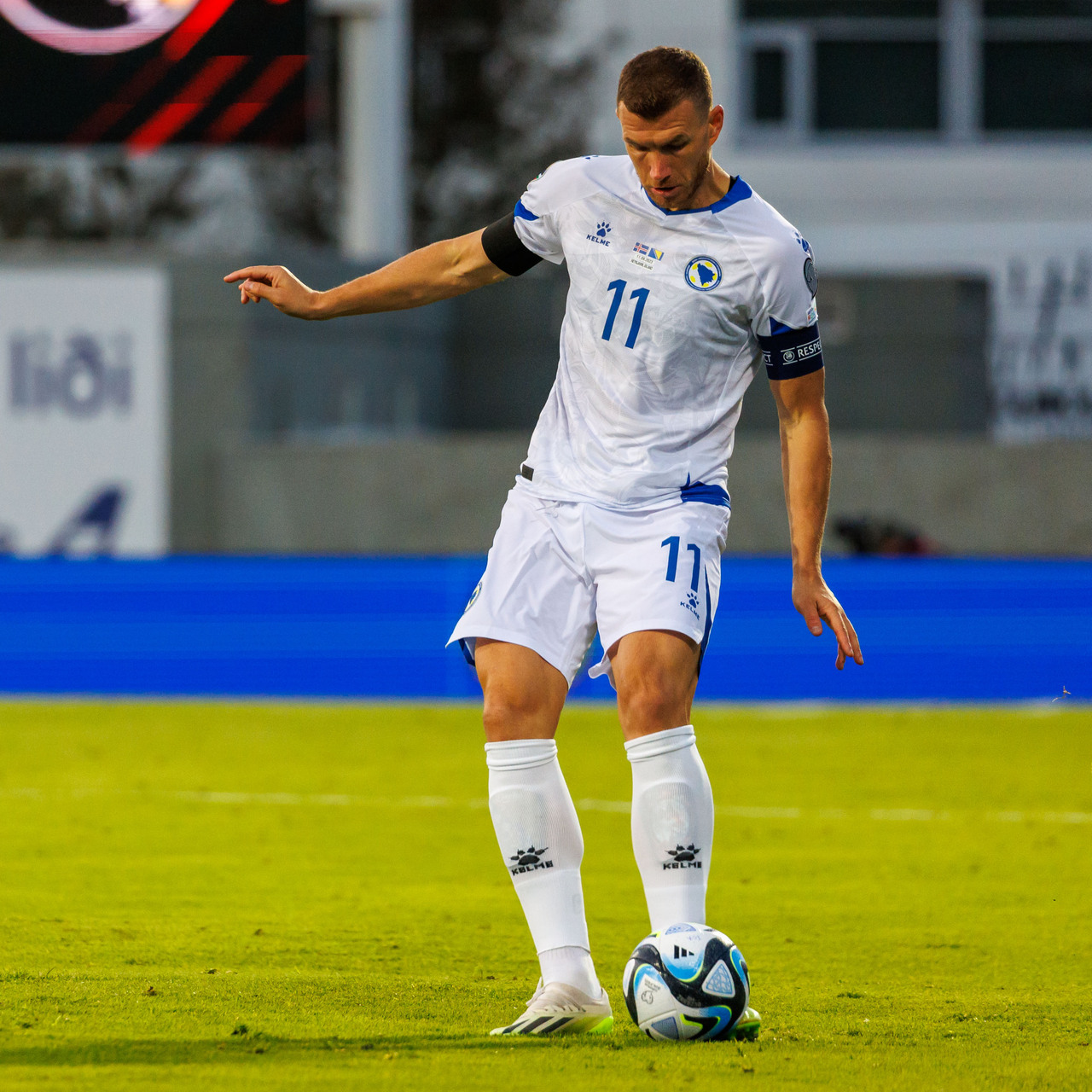 Dzeko’nun burnu kırıldı!