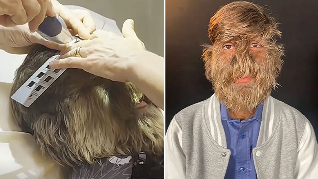 Kıllarının arasında büyük bir gizem taşıyor: Duyan yaşına inanamıyor