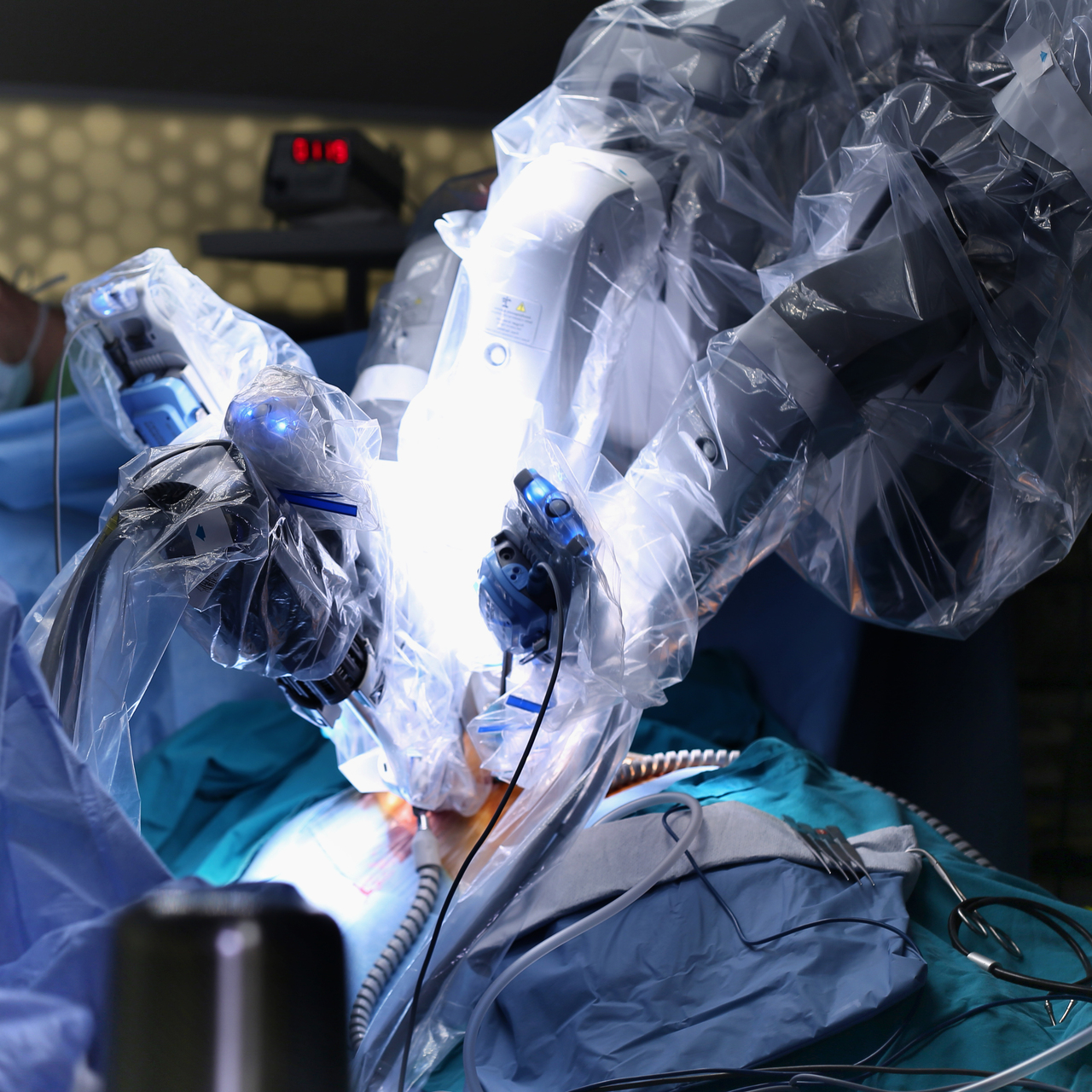 5 bin kilometre uzaktan ameliyat yaptılar