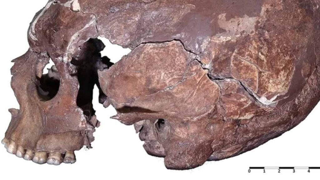 12.500 yıllık bir kafatası, atalarımızın rahatsız edici uygulamasını ortaya koydu