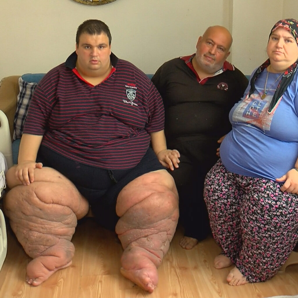270 kiloya ulaştı! “15 aydır evden çıkamıyorum, yardım edin”