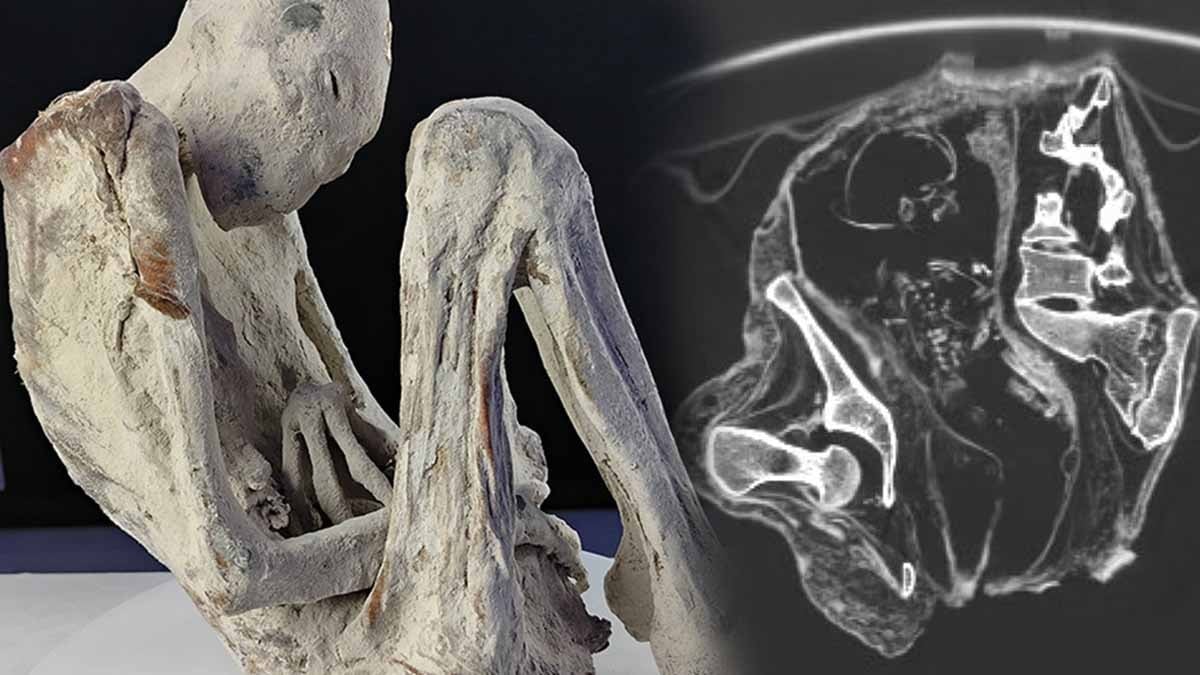 Bilim insanları, 1.200 yıllık mumyalanmış bir bedenin rahminde çarpıcı bir keşifte bulundu