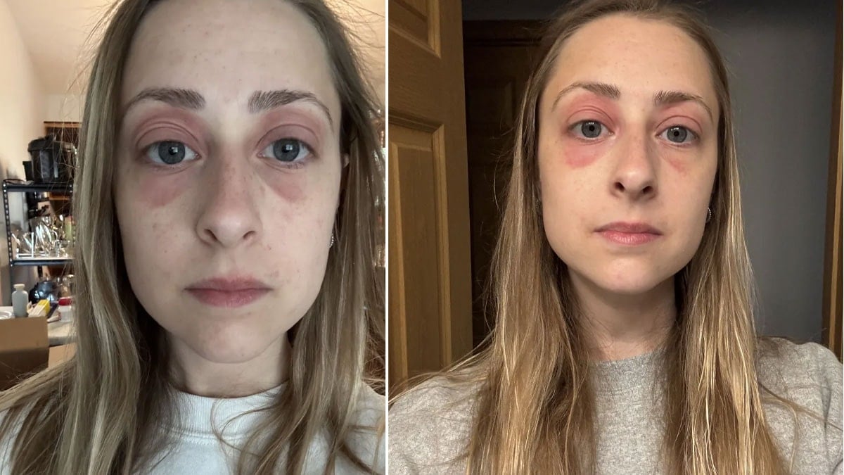 ‘Selfielerde çirkin çıkıyordum’ dedi: Sebebini öğrenince evini değiştirdi