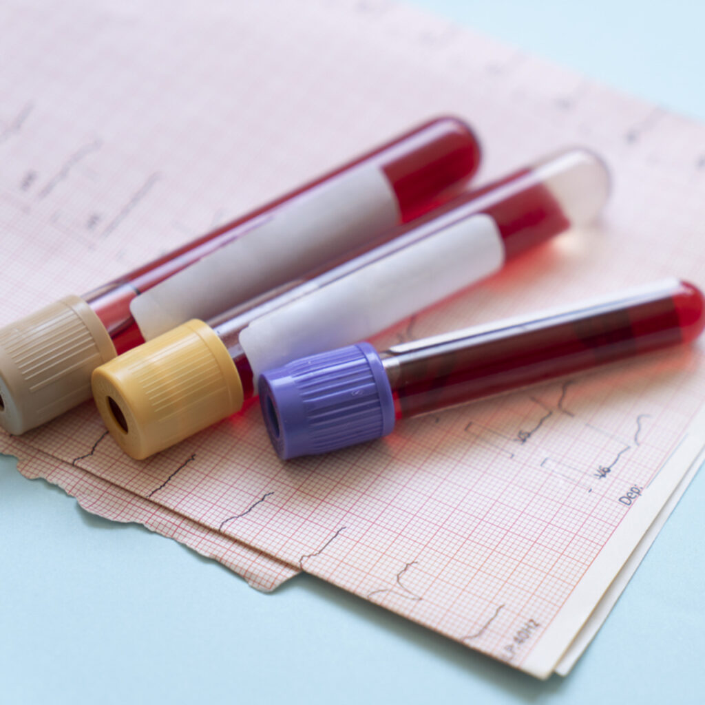 Üç tüp kan ver, hayat kurtar