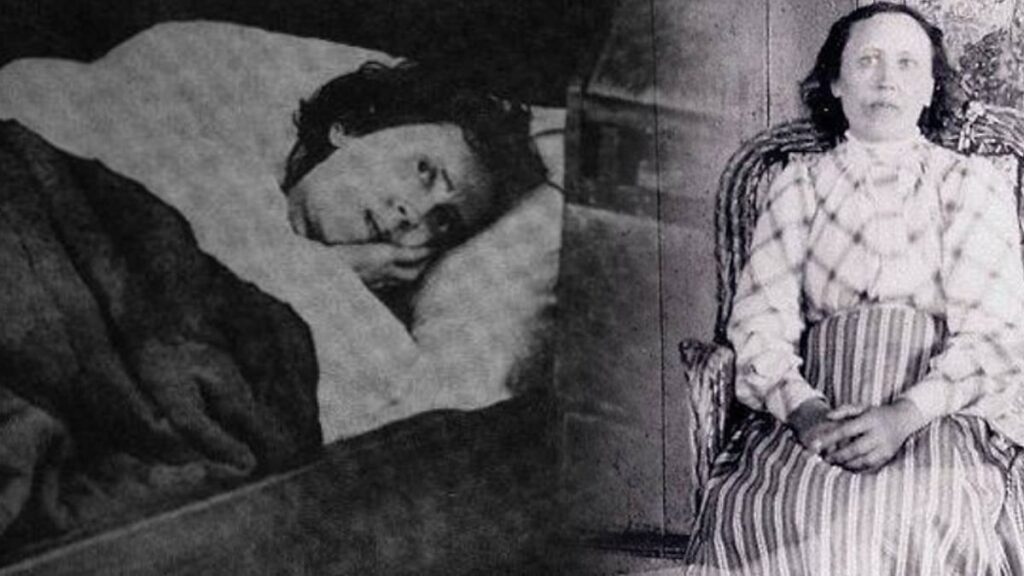 14 yaşında uyudu 46 yaşında uyandı: Uyuyan güzel gerçek oldu