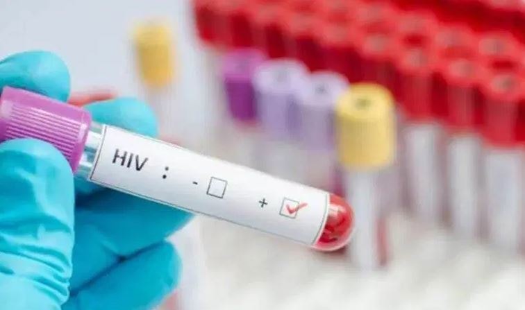 400 erkeğe bilerek HIV virüsünü bulaştırdı! Ülkede herkes paniğe kapıldı