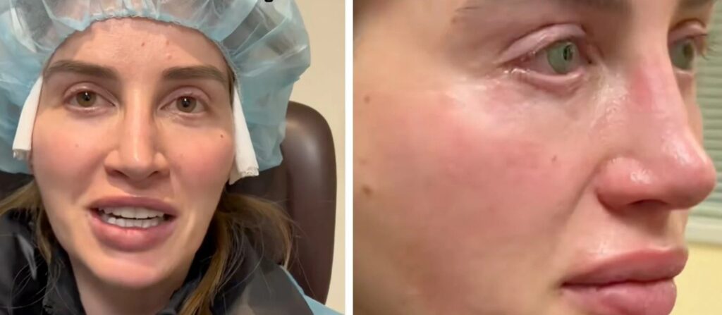 9 milyon kişi bu gözleri konuşuyor: Kalıcı olarak yaptırdı, görenler dondu kaldı