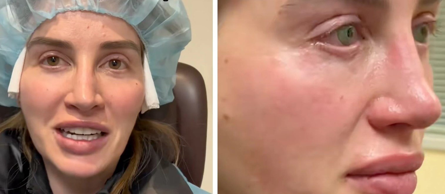 9 milyon kişi bu gözleri konuşuyor: Kalıcı olarak yaptırdı, görenler dondu kaldı