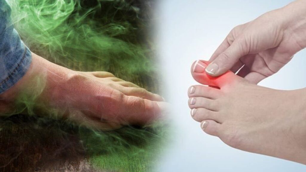 Ayak mantarının kökünü kurutuyor: 2 malzeme yetiyor, kokudan eser kalmıyor