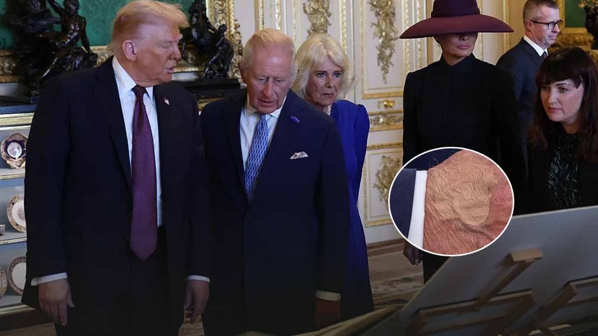 Donald Trump, İngiltere ziyareti sırasında bu kez de gizemli sarı lekeyle yeni sağlık endişelerine yol açtı