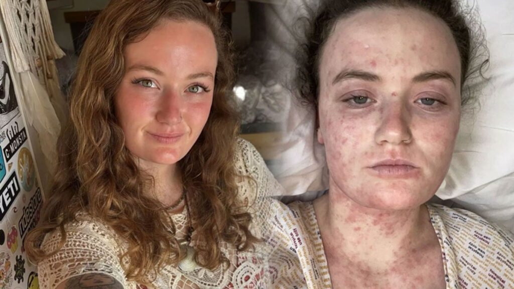 Sırt ağrısıyla başladı, ölümün kıyısından döndü: Yanlış teşhis hayattan koparıyordu