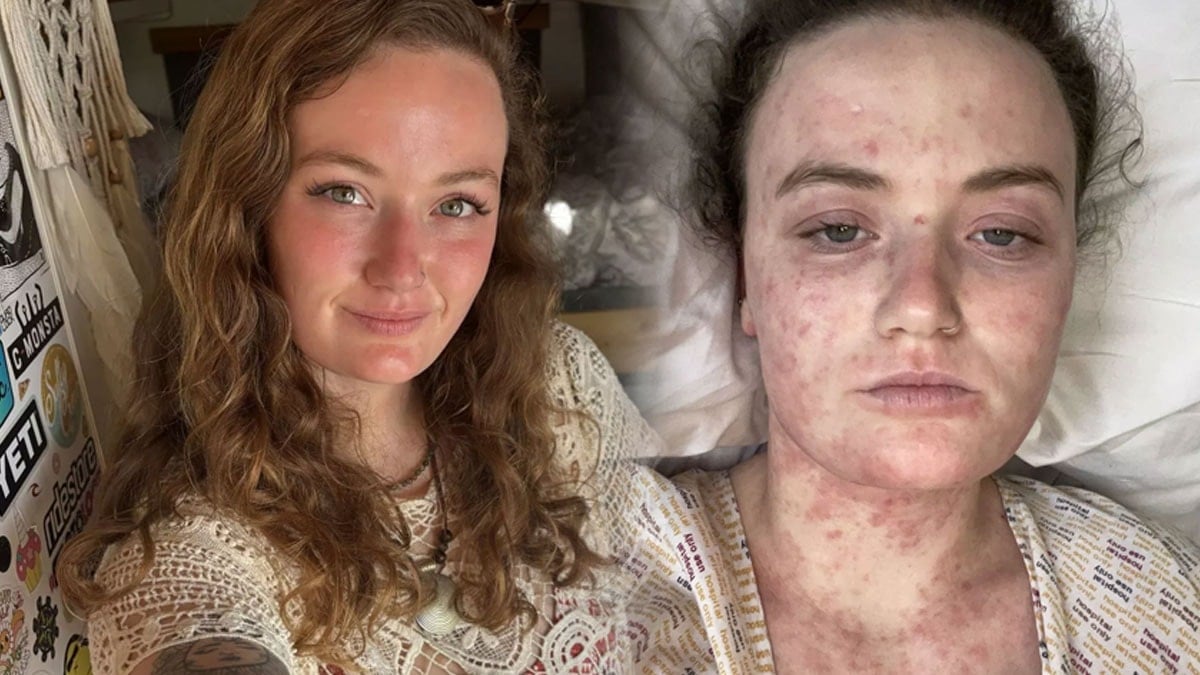 Sırt ağrısıyla başladı, ölümün kıyısından döndü: Yanlış teşhis hayattan koparıyordu