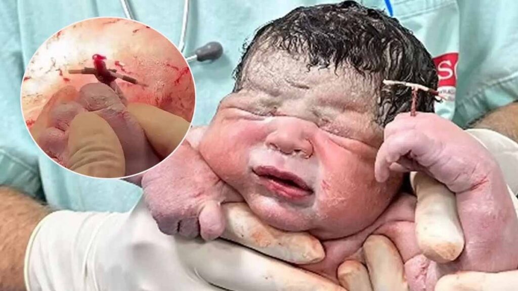 Yeni doğan bebeğin elinde tuttuğu şeyi görenler gözlerine inanamadı! Annesi gülse mi ağlasa mı bilemedi…