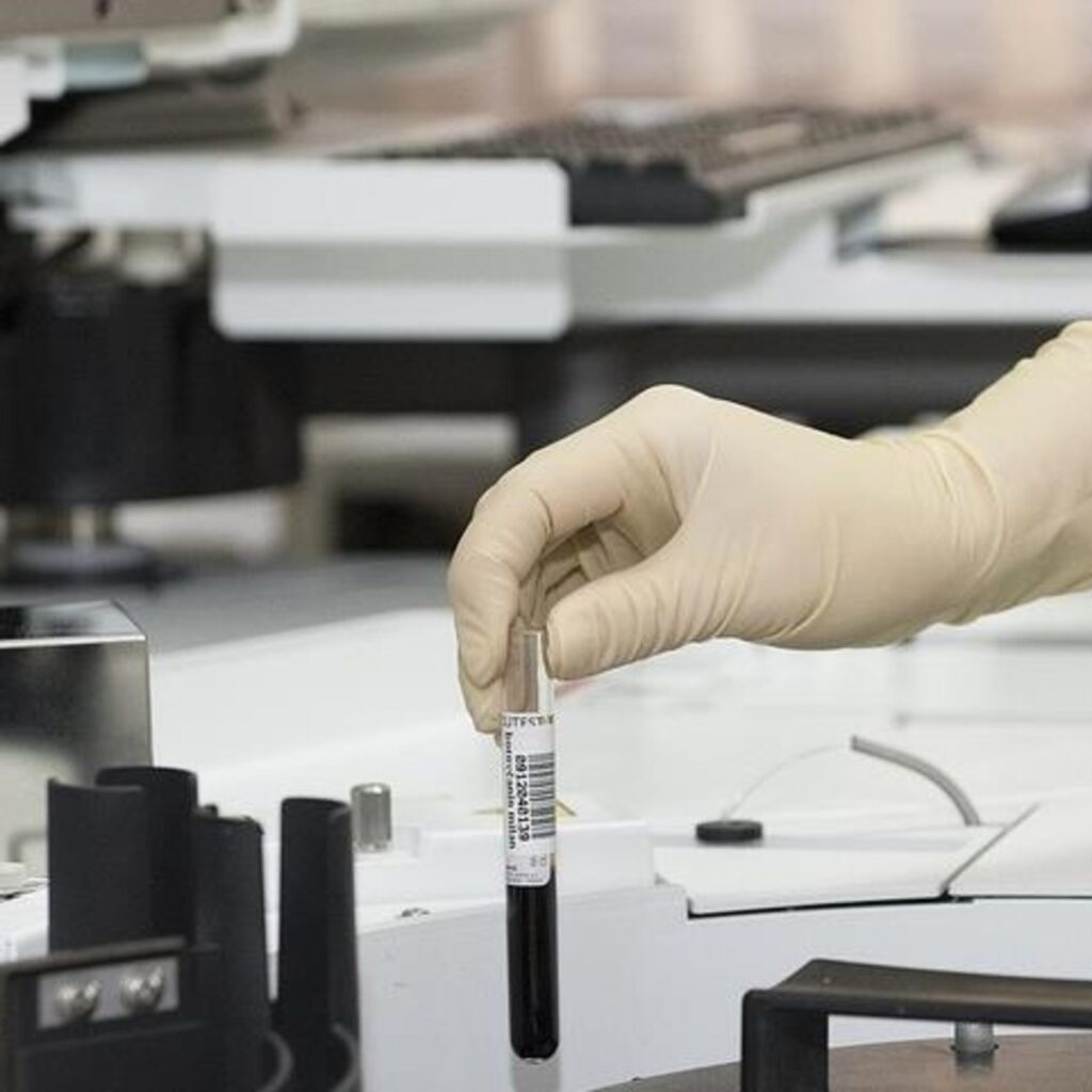 15 aylık bebeğin yemek borusundan pil ve Lego çıkarıldı