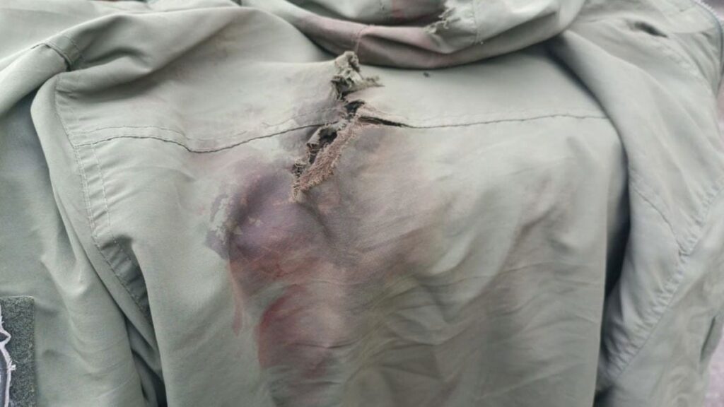 Birinci Dünya Savaşı hastalığı yeniden hortladı: Yüzyıl sonra ilk kez görüldü