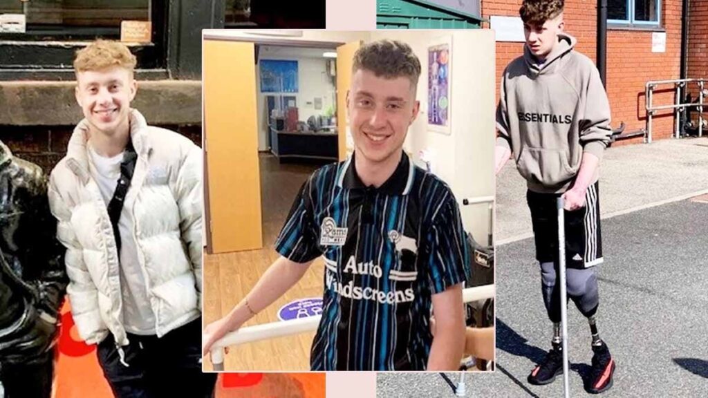 Grip sandı, sepsis olduğunu öğrendi: Doğum gününe günler kala 2 bacağı diz altından kesildi! İşte griple karıştırılan belirtiler