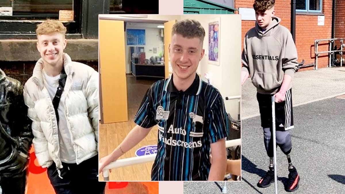 Grip sandı, sepsis olduğunu öğrendi: Doğum gününe günler kala 2 bacağı diz altından kesildi! İşte griple karıştırılan belirtiler