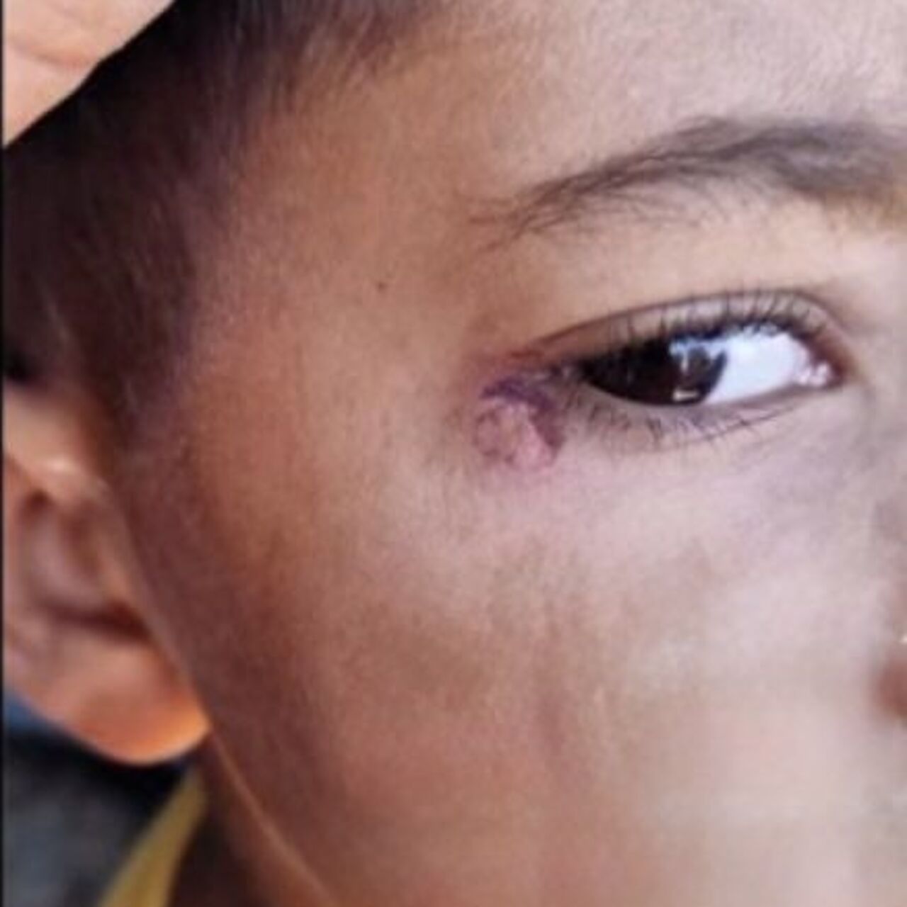 Öğrencinin yüzünde sigara söndürdü!