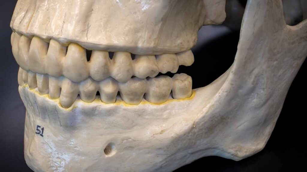 Tarih kitapları değişiyor! 2 milyon yıllık diş minesindeki ‘protein’, kuzenlerimiz hakkında bildiğimiz her şeyi altüst etti