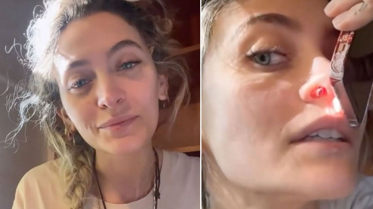 Ünlü şarkıcı burnundan gelen ‘ıslık sesinin’ sebebini açıkladı