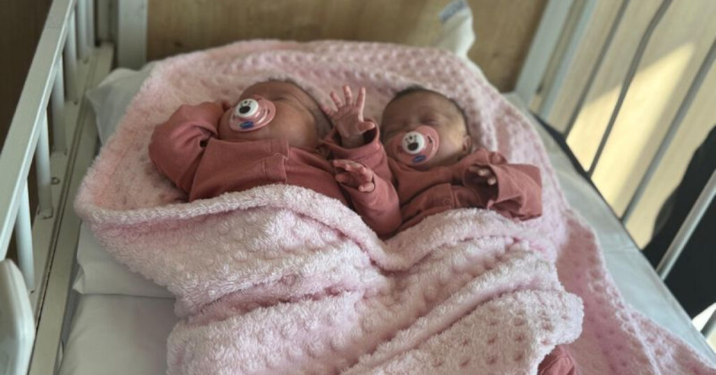 Prematüre ikizler, anjiyoyla hayata tutundu