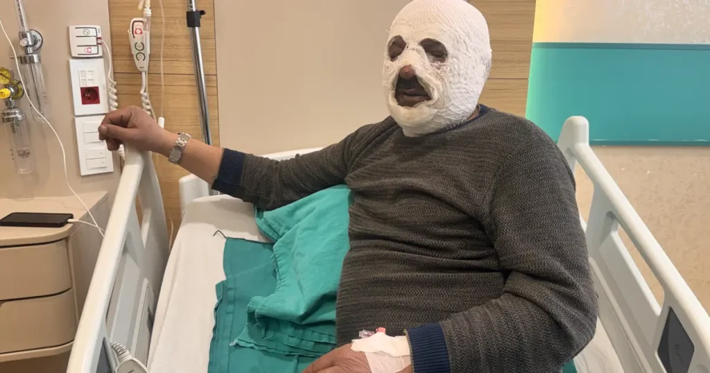 Sular dondu, ateşi hızlandırmak istedi: “Ben yandım kimse yanmasın”